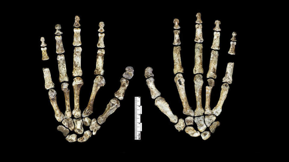 Fossil hand (palm and dorsum) of H. naledi